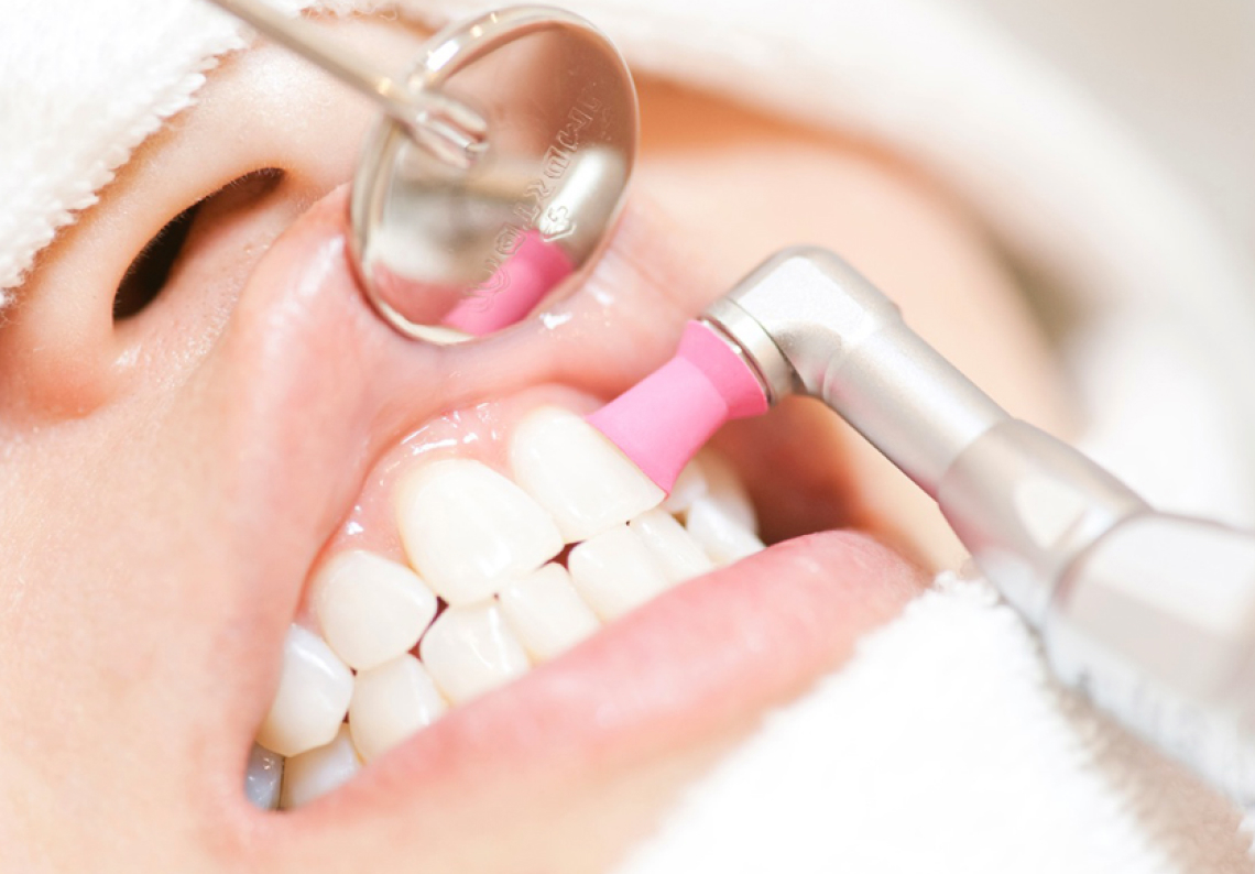 虫歯予防を徹底サポート