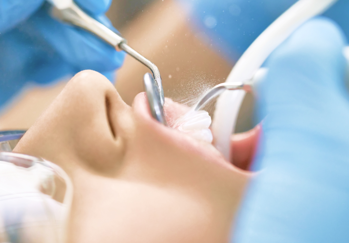 歯周治療に注力